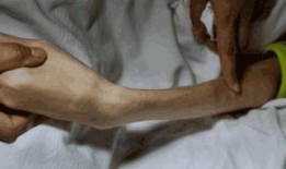 骨瘦如柴 在線觀看,揭示人生低谷的勵志故事