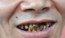 百獸瓶子爆料怎么做視頻,視頻生成技巧全解析