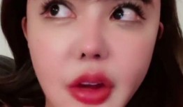 韓安冉整形醫生爆料視頻,揭秘網紅整形背后的真相